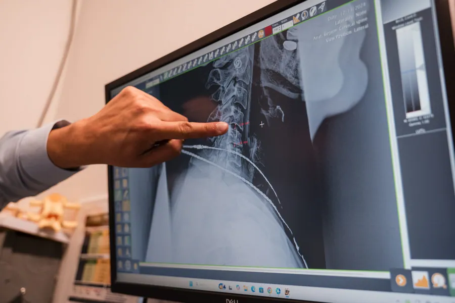 Spine X-Ray care at Zamora Chiropractic in Bentonville, AR