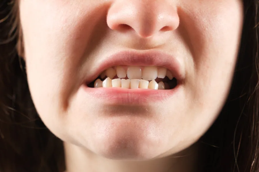 TMD/TMJ care at Zamora Chiropractic in Bentonville, AR